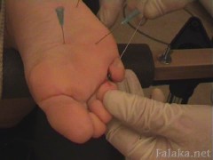 needle_and_electricity_128